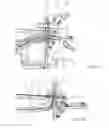 Fig. 09 - Container and supporting structure for housing an organ