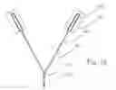 Fig. 16 - Container and supporting structure for housing an organ