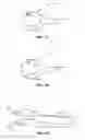 Fig. 09 - DECORATIVE SOCK STABILIZER