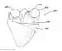 Fig. 01 - Baby handling device