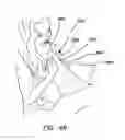 Fig. 32 - Baby handling device