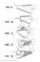 Fig. 06 - Method of making an article of footwear including knitting a knitted component of warp knit construction forming a seamless bootie with wrap-around portion