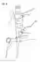 Fig. 09 - System of accessories for use with bronchoscopes