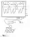 Fig. 02 - Method for checking tooth positions