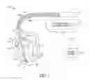 Fig. 02 - Systems and methods for evaluating hemodynamic response to atrial fibrillation