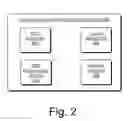Fig. 03 - QRS complex identification in electrocardiogram signals