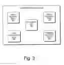 Fig. 04 - QRS complex identification in electrocardiogram signals