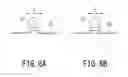 Fig. 07 - X-ray CT apparatus and display method for CT image