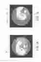 Fig. 08 - X-ray CT apparatus and display method for CT image