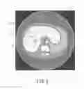 Fig. 09 - X-ray CT apparatus and display method for CT image