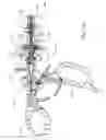 Fig. 06 - Surgical device and linkage system for same