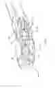 Fig. 19 - Surgical spacer instrument and method