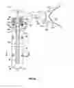 Fig. 03 - Dilation system and method