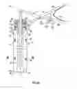 Fig. 04 - Dilation system and method