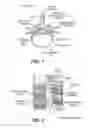 Fig. 02 - Multiple pathways for spinal nerve root decompression from a single access point
