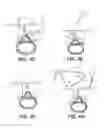 Fig. 07 - Multiple pathways for spinal nerve root decompression from a single access point