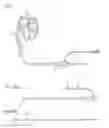 Fig. 02 - Medical device and treatment method