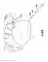 Fig. 47 - Systems and methods for percutaneous access, stabilization and closure of organs