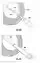 Fig. 48 - Systems and methods for percutaneous access, stabilization and closure of organs
