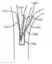 Fig. 01 - MEDICAL DEVICES AND METHODS FOR LUNG VOLUME REDUCTION