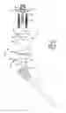 Fig. 02 - Patient-specific glenoid depth control