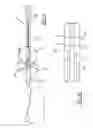 Fig. 07 - Patient-specific glenoid depth control