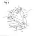 Fig. 02 - Surgical cutter