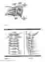 Fig. 02 - LATERAL MASS FIXATION IMPLANT