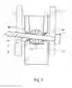 Fig. 02 - LOCKABLE INTRAMEDULLARY NAIL COMPRISING GUIDE WIRE PASSAGES