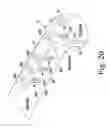 Fig. 11 - Metatarsal fixation device, system and method