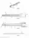 Fig. 02 - Medical apparatus, and surgical method