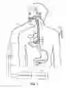 Fig. 02 - Medical probe and method of using same