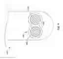 Fig. 09 - DOUBLE MICRO-ELECTRODE CATHETER