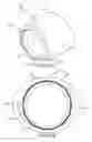 Fig. 35 - Surgical instrument for removing an implanted object