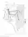 Fig. 02 - SURGICAL DRAPE WITH STERILE SYSTEM ACCESS