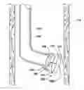 Fig. 01 - SYSTEMS AND METHOD FOR MICROACCESS TRANSESOPHAGEAL SURGERY