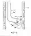 Fig. 02 - SYSTEMS AND METHOD FOR MICROACCESS TRANSESOPHAGEAL SURGERY