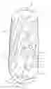 Fig. 01 - Autografting osteotome
