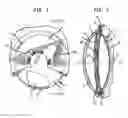 Fig. 02 - Micropatterned intraocular implant