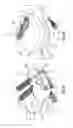 Fig. 02 - Low profile intervertebral implant