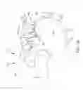 Fig. 09 - Systems for and methods of diagnosing and treating a sacroiliac joint disorder