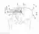 Fig. 12 - Systems for and methods of diagnosing and treating a sacroiliac joint disorder