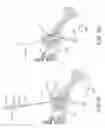 Fig. 14 - Systems for and methods of diagnosing and treating a sacroiliac joint disorder
