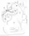 Fig. 23 - Systems for and methods of diagnosing and treating a sacroiliac joint disorder