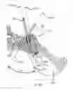 Fig. 26 - Systems for and methods of diagnosing and treating a sacroiliac joint disorder