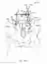 Fig. 28 - Systems for and methods of diagnosing and treating a sacroiliac joint disorder