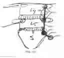 Fig. 30 - Systems for and methods of diagnosing and treating a sacroiliac joint disorder
