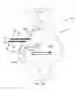 Fig. 32 - Systems for and methods of diagnosing and treating a sacroiliac joint disorder