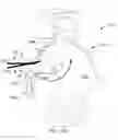 Fig. 34 - Systems for and methods of diagnosing and treating a sacroiliac joint disorder