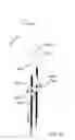 Fig. 52 - Systems for and methods of diagnosing and treating a sacroiliac joint disorder